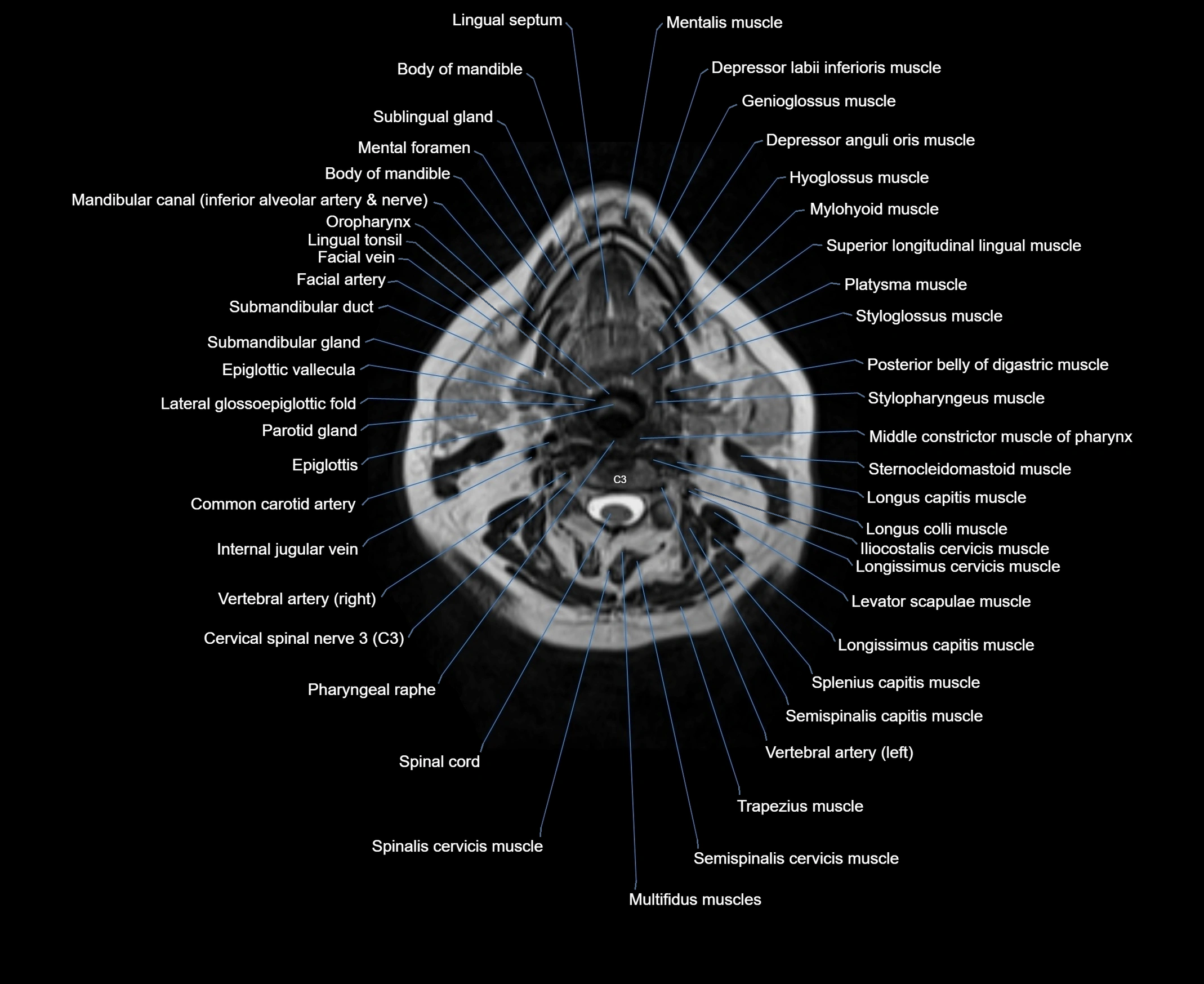 MRI Neck 3D labelled cross section anatomy axial 3t image-00001-00042.webp